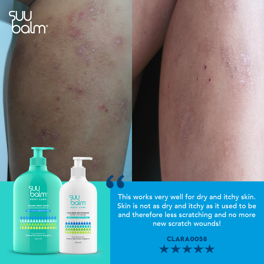 Suu Balm Ceramide Moisturiser (Rapid Itch Relief)