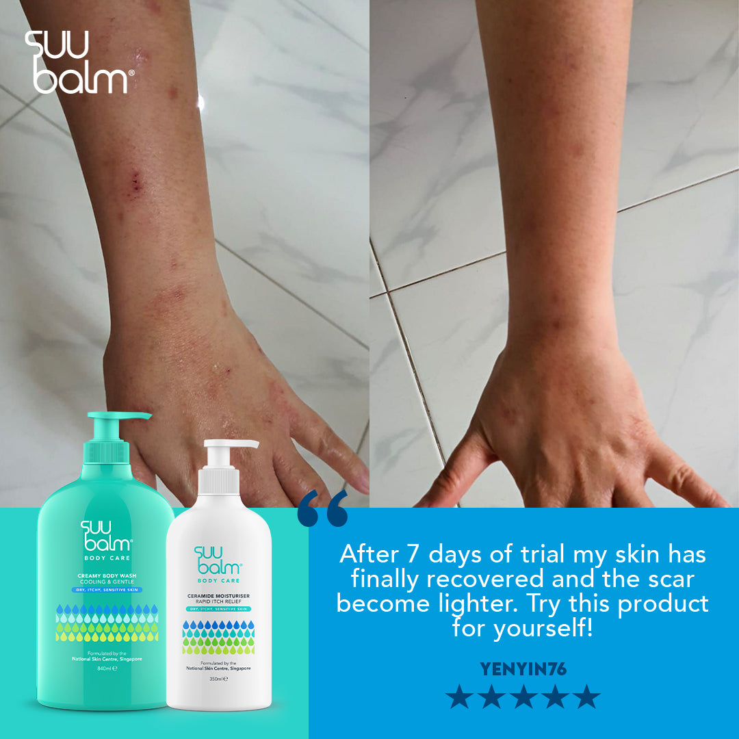 Suu Balm Ceramide Moisturiser (Rapid Itch Relief)