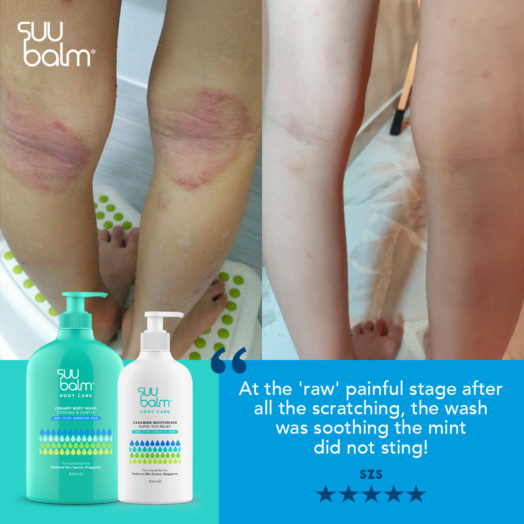 Suu Balm Ceramide Moisturiser (Rapid Itch Relief)