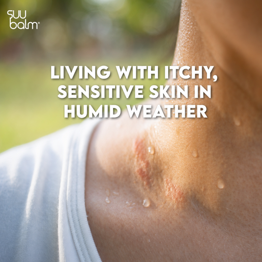 Why itchy, sensitive skin feels worse in humid weather, and what can help