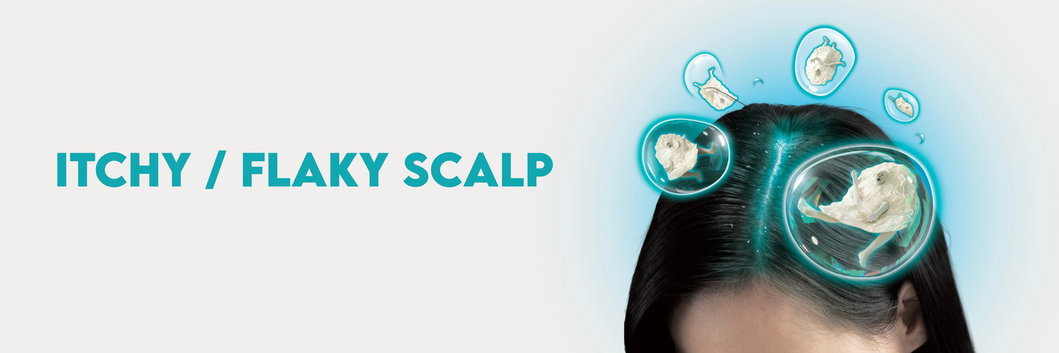Itchy / Flaky Scalp