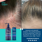 Suu Balm Rapid Itch Relief Scalp Spray Moisturiser