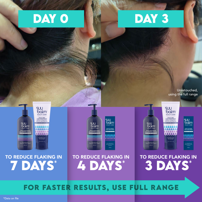 Gentle & Moisturising Itch Relief Scalp Care Bundle