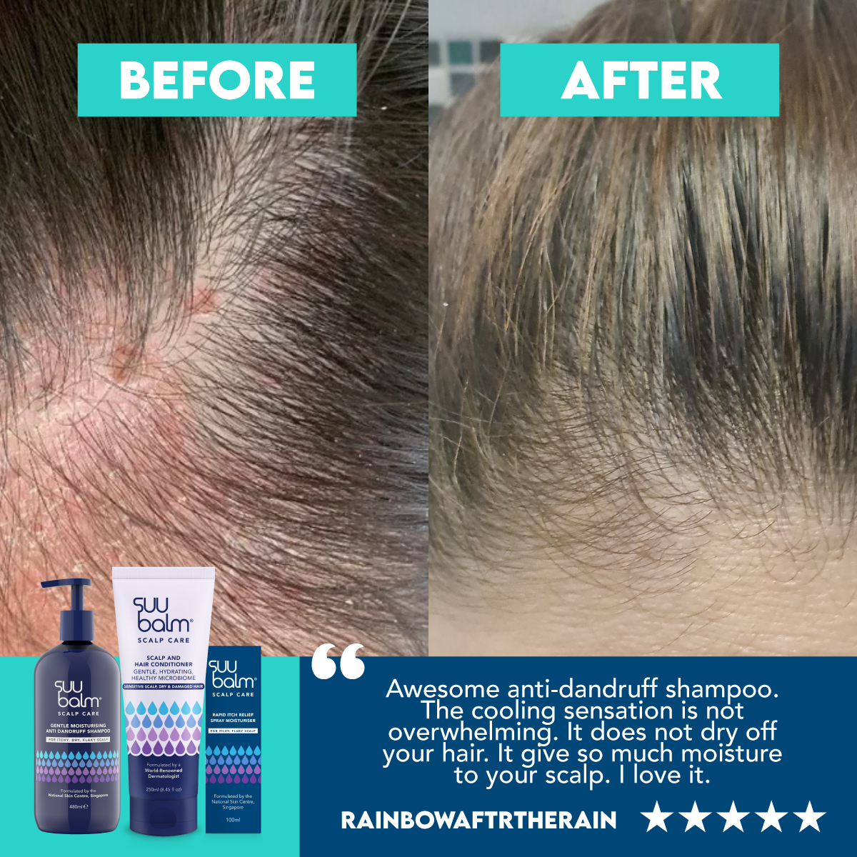 Gentle & Moisturising Itch Relief Scalp Care Bundle